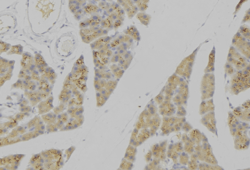 PLA2G2A / SPLA2 Antibody