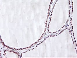 HES1 / HES-1 Antibody (clone OTI2D2)