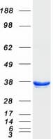 Human PCA1 / ALKBH3 Protein (Recombinant Myc-DDK (Flag))