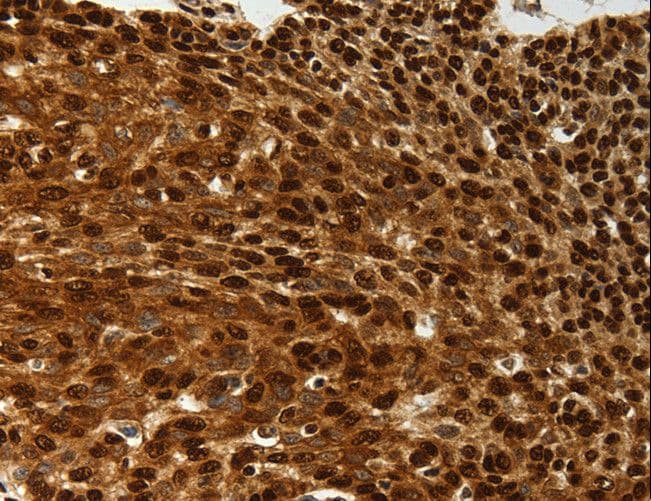 Polyclonal Rabbit anti-Human SCN1A / Nav1.1 Antibody (IHC)