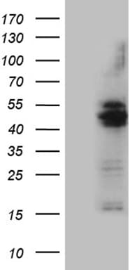 AGPAT9 / MAG1 Antibody (aa41-131, clone OTI6A3, Carrier-free)