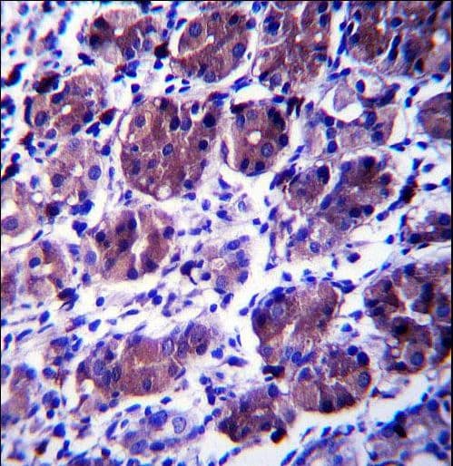 Polyclonal Rabbit anti-Human CCDC22 Antibody (aa530-558, IHC, WB)