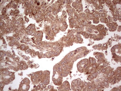 UBE2D2 / UBCH5B Antibody (clone OTI2C2, Carrier-free)