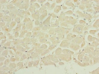 DUSP22 / JSP 1 Antibody
