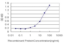 FVT1 / KDSR Antibody (clone 2B2-3C11)
