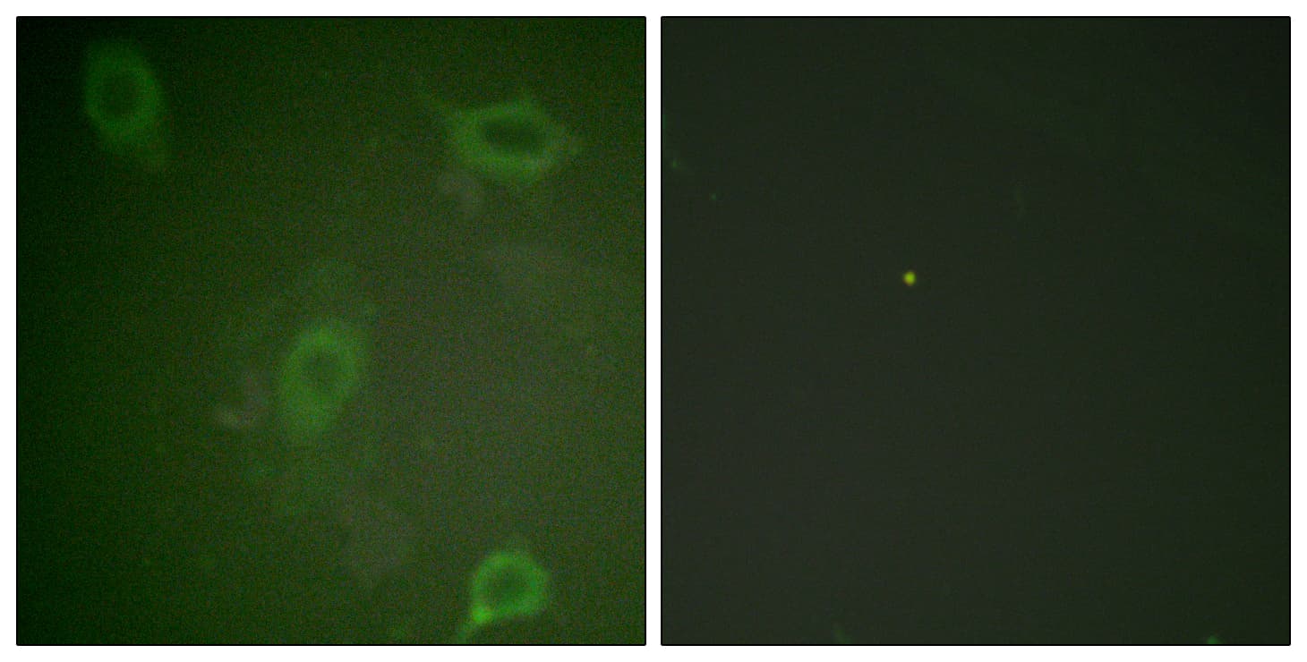 APP / Beta Amyloid Precursor Antibody (phospho-Thr743/Thr668)