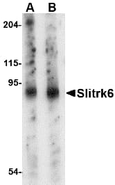 IHC-plus™ SLITRK6 Antibody