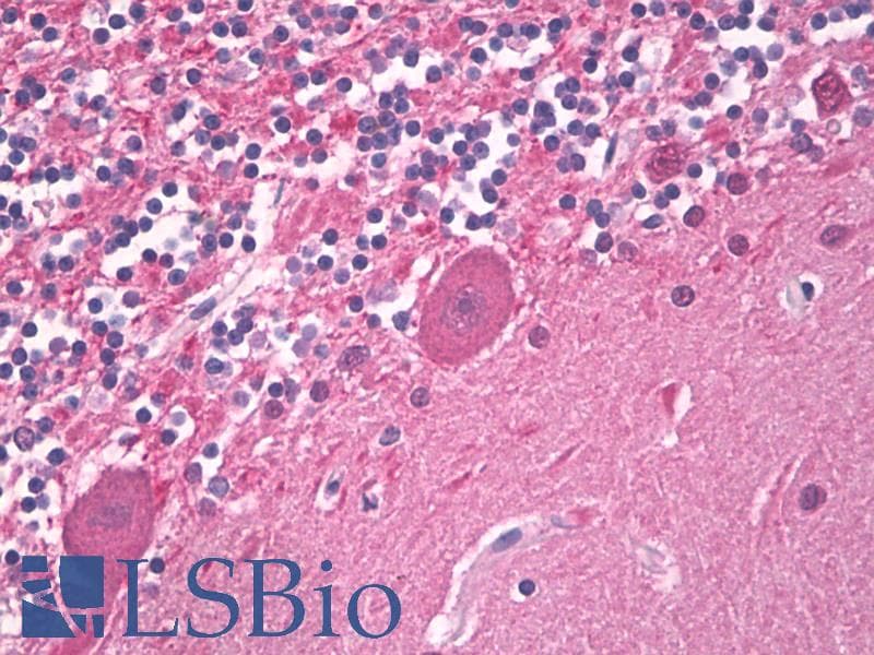 IHC-plus™ UCHL1 / PGP9.5 Antibody
