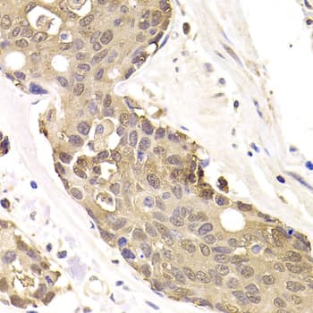 FKBP4 / FKBP52 Antibody