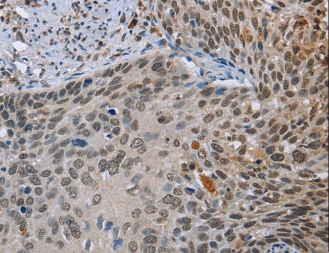 Polyclonal Rabbit anti-Human NMT1 Antibody (IHC)