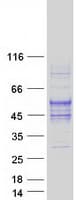 Human TMIGD2 Protein (Recombinant Myc-DDK (Flag))