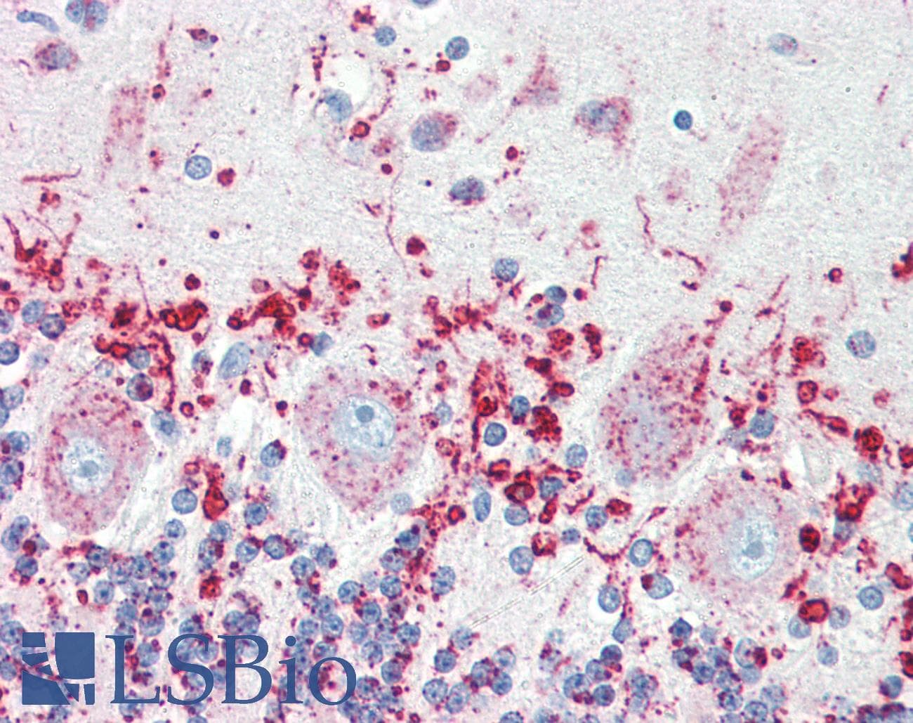 IHC-plus™ Polyclonal Rabbit anti-Human LIMPII / SCARB2 Antibody (IHC, IF, WB)