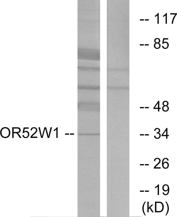 OR52W1 Antibody (aa271-320)