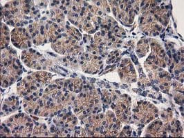 Monoclonal Mouse anti-Human EIF4E2 / IF4e Antibody (clone OTI1F2, IHC, WB)