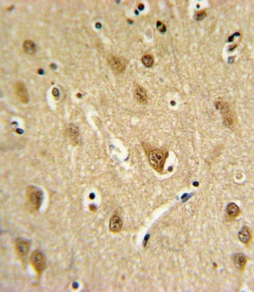 ST8SIA4 Antibody (aa186-214)
