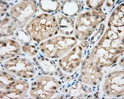 NIT2 Antibody (clone OTI3F3)
