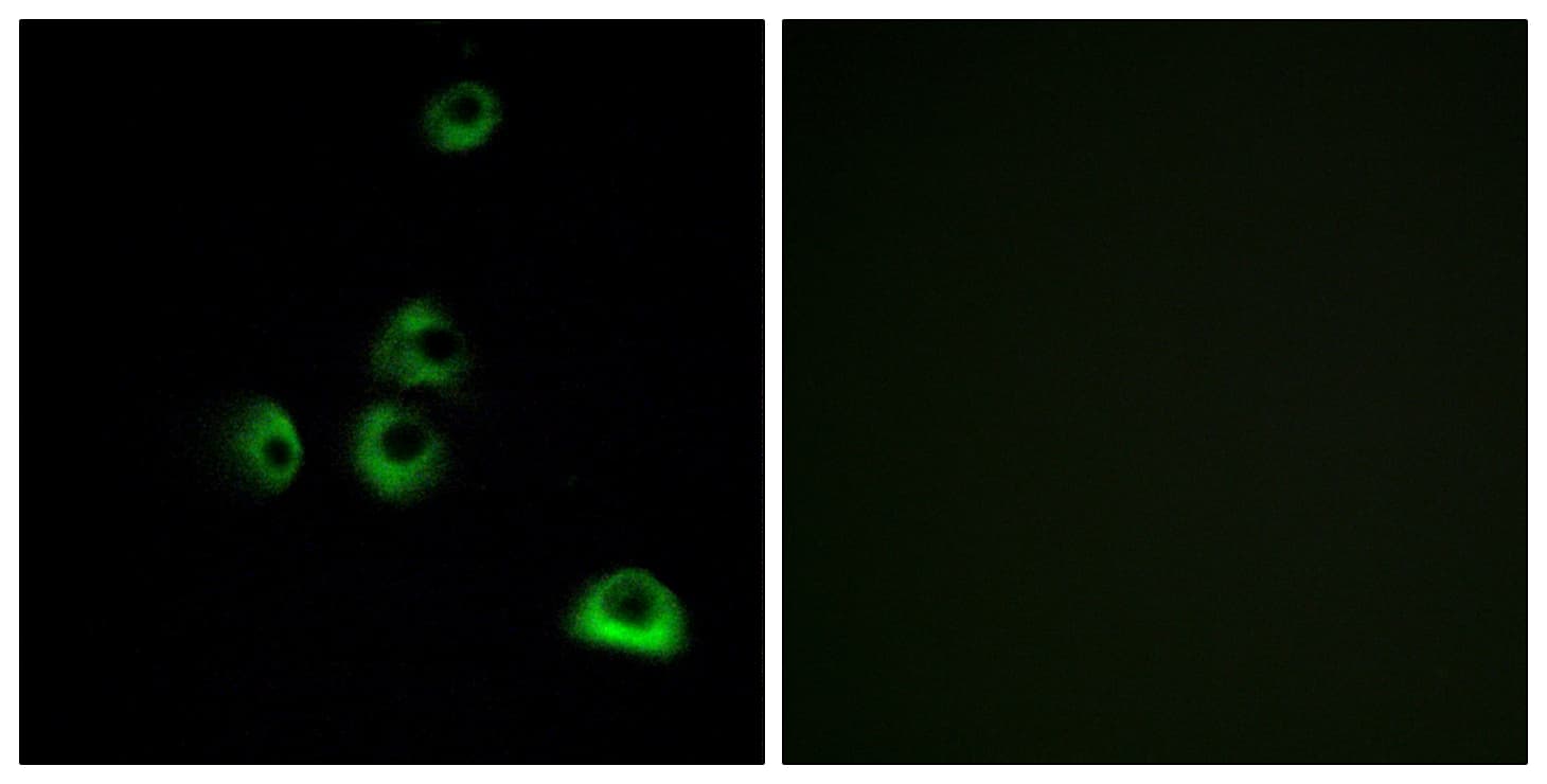OR2M5 Antibody (aa241-290)