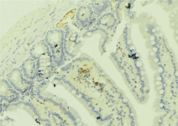 Polyclonal Rabbit anti-Human CCP110 Antibody (IHC, IF, WB)