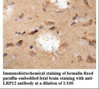 LRP12 Antibody (aa242-428)