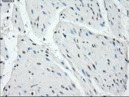 PRKAR1A Antibody (clone OTI6C7)