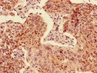 ACYP2 Antibody