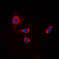 GABRB1 Antibody (C-Terminus)