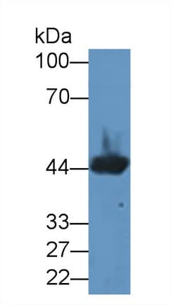 CKM / Creatine Kinase MM Antibody (aa11-367)
