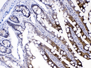 Polyclonal Rabbit anti-Human I-FABP / FABP2 Antibody (IHC, WB)