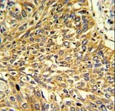 Polyclonal Rabbit anti-Human RGP1 Antibody (aa243-271, IHC, WB)