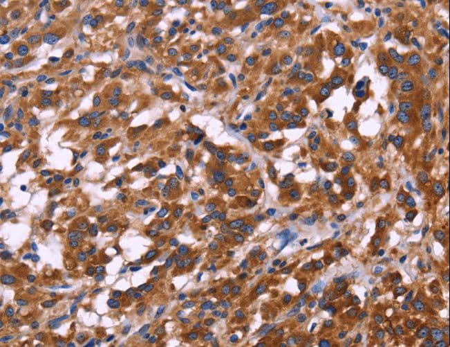 KIR2DL1+3+4 + KIR2DS4 Antibody