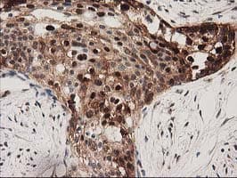 SQSTM1 Antibody (clone OTI4G9)