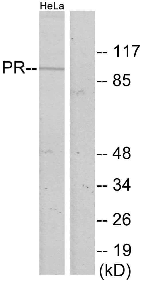 IHC-plus™ PR / Progesterone Receptor Antibody (aa371-420)