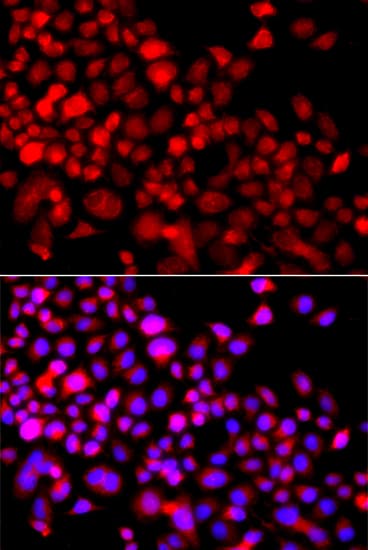 Polyclonal Rabbit anti-Human CALCOCO1 / CoCoa Antibody (IHC, IF, WB)