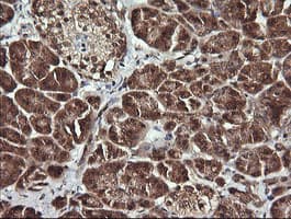 Monoclonal Mouse anti-Human ANAPC11 / APC11 Antibody (clone OTI1F2, IHC, WB)