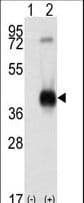 Polyclonal Rabbit anti-Human CAMK1 / CAMKI Antibody (aa341-370, IHC, WB)