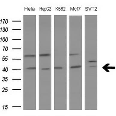LGALS9 / Galectin 9 Antibody (clone OTI2E10)