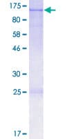 Human OPA1 Protein (Recombinant GST)