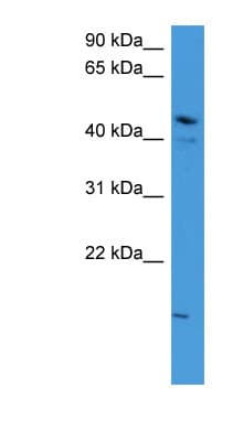 ZNF713 Antibody (aa63-112)