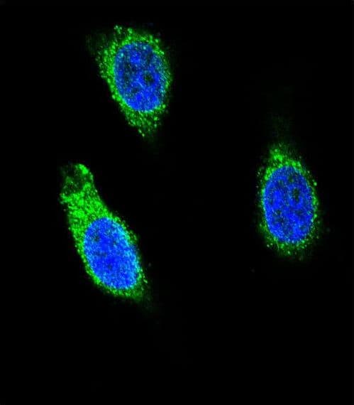 RNH1 Antibody (aa425-454)