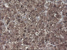 ACY1 / Aminoacylase 1 Antibody (clone OTI2F1)