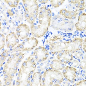 SPICE1 / CCDC52 Antibody