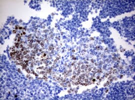 MKI67 / Ki67 Antibody (aa1160-1493, clone OTI13F12)