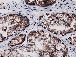 Monoclonal Mouse anti-Human SQSTM1 Antibody (clone OTI4E2, IHC, IF, WB)