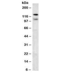 Monoclonal Mouse anti-Human CDH2 / N Cadherin Antibody (clone 8C11, IHC, IF, WB)
