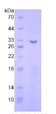 Human ITFG1 / TIP Protein (Recombinant His, N-Terminal)