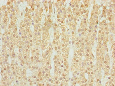Polyclonal Rabbit anti-Human DHRS3 / SDR1 Antibody (IHC, WB)