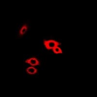 GLA / Alpha Galactosidase Antibody