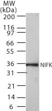 Monoclonal Mouse anti-Human NIFK / MKI67IP Antibody (clone 18E148, aa100-200, WB)