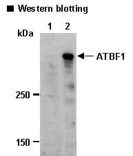 IHC-plus™ Polyclonal Rabbit anti-Human ZFHX3 / ATBF1 Antibody (IHC, IF, WB)