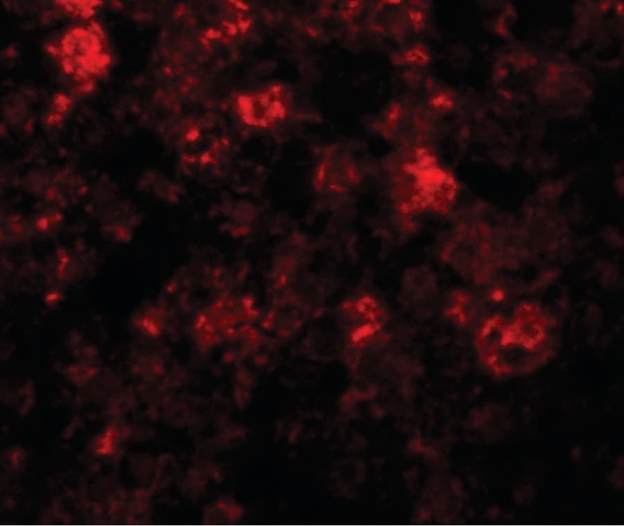 SLC39A12 / ZIP12 Antibody